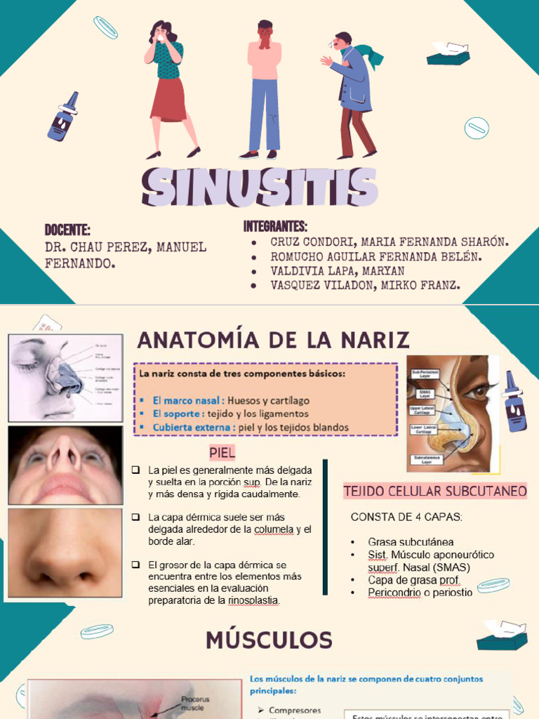 SINUSITIS | PDF