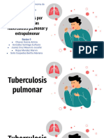 Tuberculosis