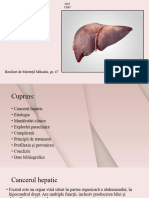 Cancer Hepatic