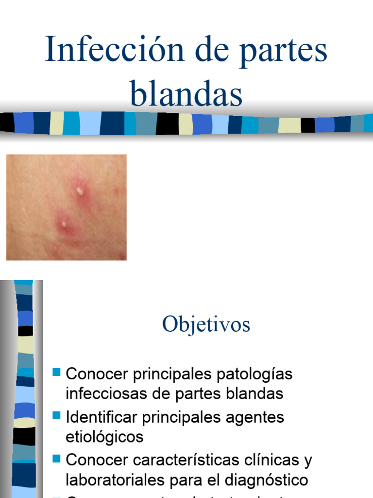Infección de Partes Blandas | PDF