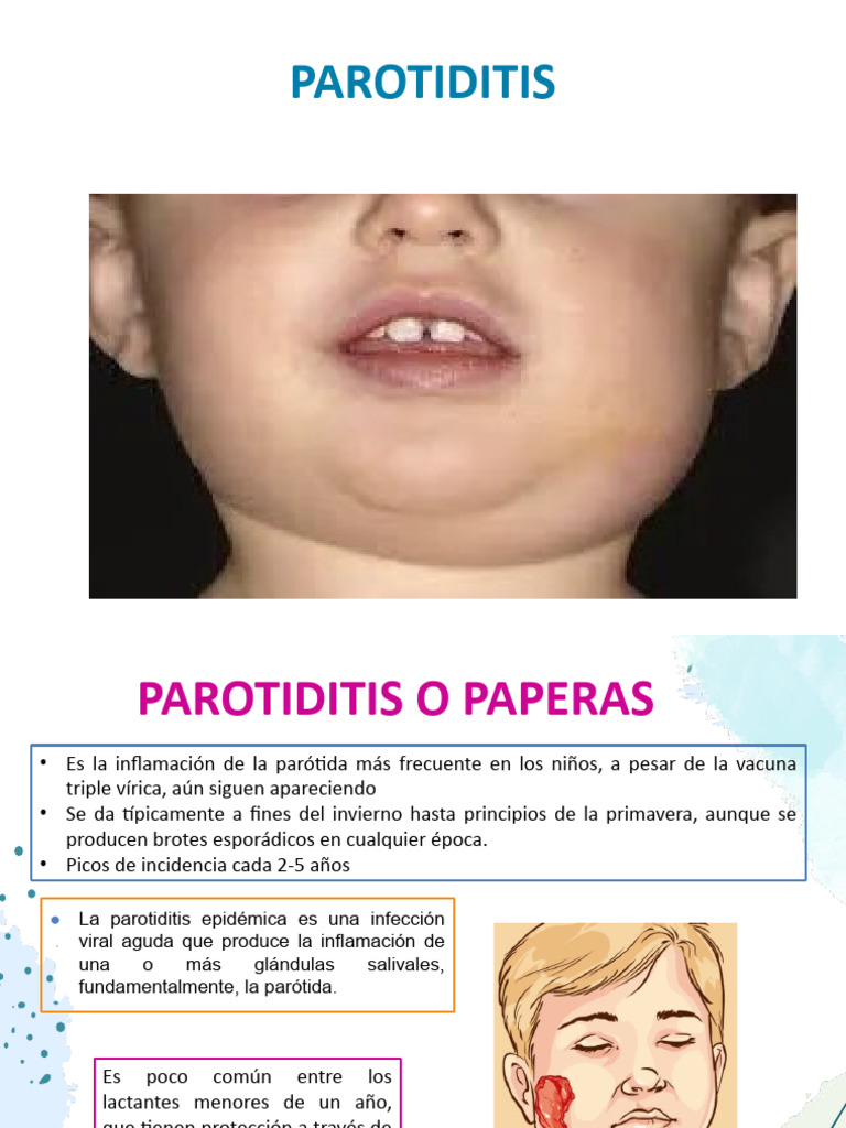 Parotiditis en Niños: Diagnóstico y Tratamiento | PDF