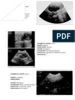 Ecografia Ovarios e Intestino