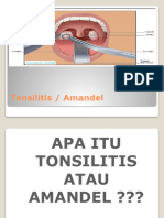 Ppt Tonsilitis