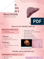 Iguaran Garzon-Tumores Hepaticos