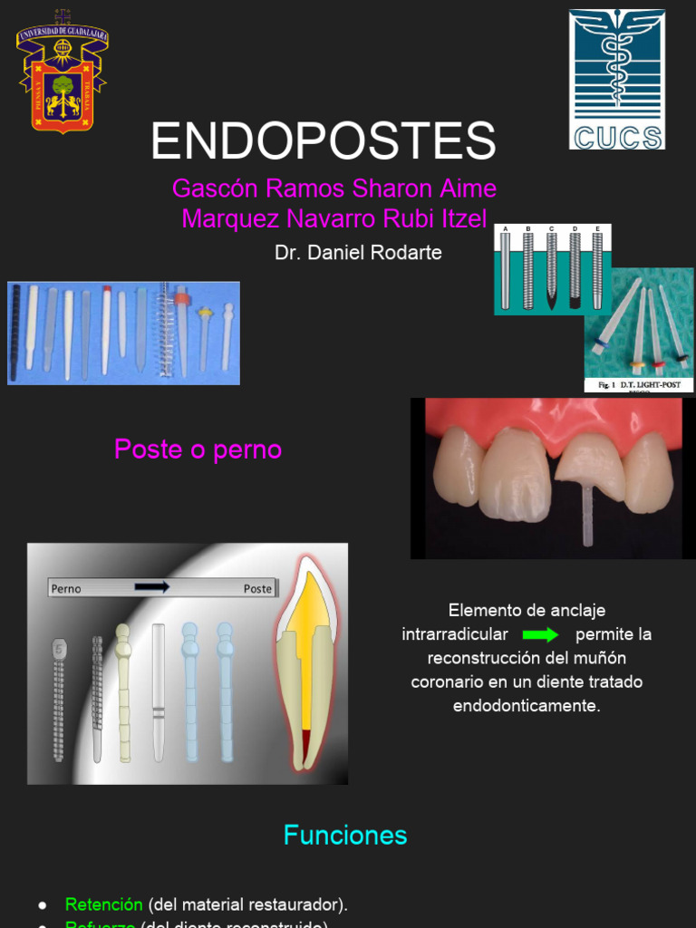 Endopostes Guía | PDF