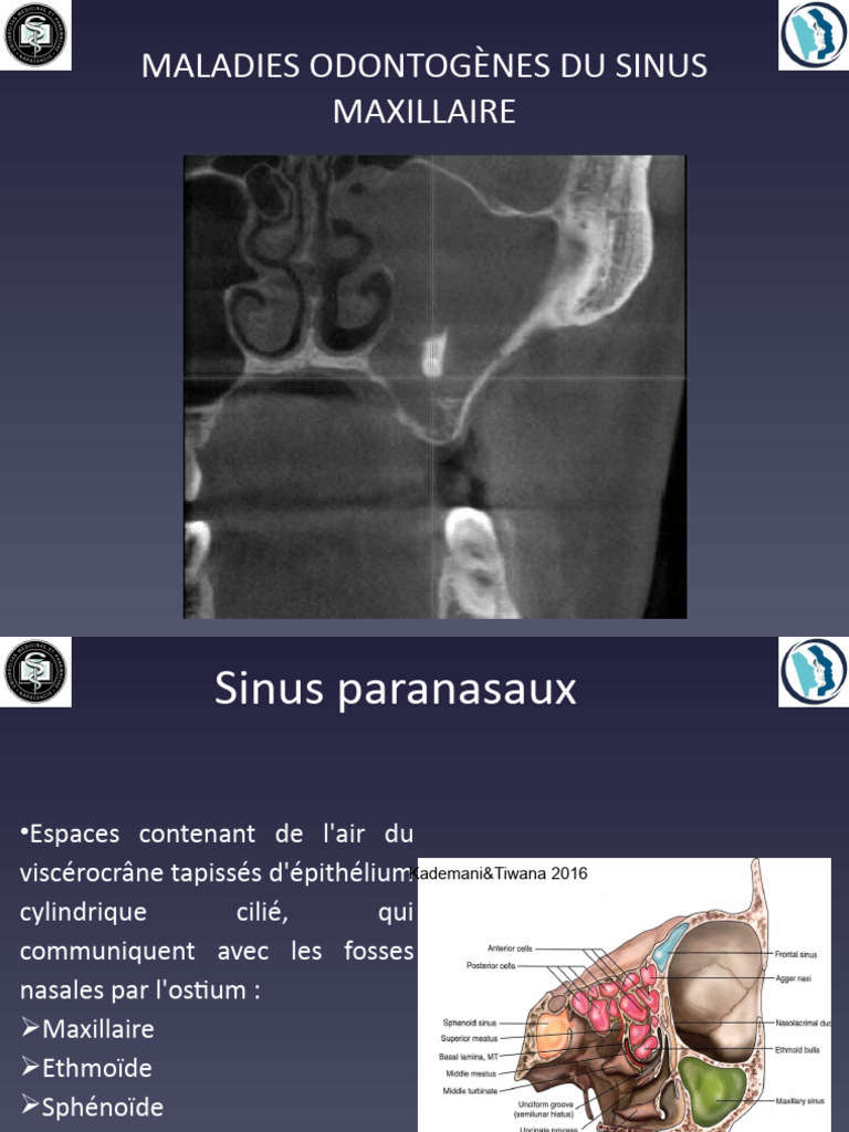 La Pathologie Du Sinus Maxillaire PDF