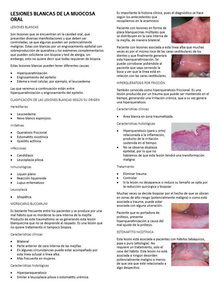 lesiones-blancas-en-la-mucosa-oral-pdf-epitelio-c-ncer