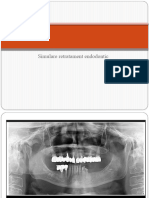 Etapele retratamentului endodontic