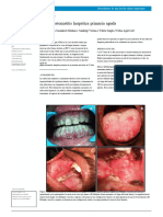 Bcr-2013-200074 Gingivoestomatitis Herpetica