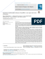 Pleomorphic Adenoma 5