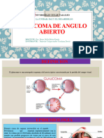 Glaucoma