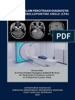 Peran MRI Pada Tumor CPA
