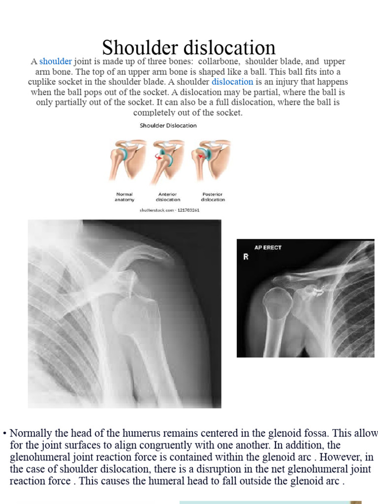 Shoulder Dislocation PDF Shoulder Anatomical Terms Of Motion