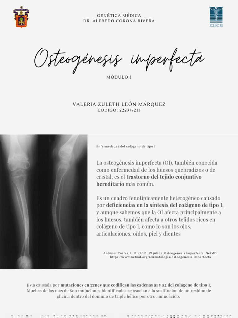 osteogenesis-imperfecta-pdf