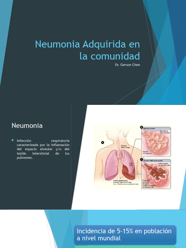 Neumonía Adquirida en La Comunidad | PDF | Neumonía | Tos