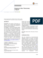 Macular Hole Development After Vitrectomy For Floaters A Case Report