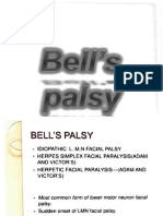 Bell's Palsy???