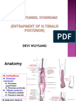 Tarsal Tunnel Syndrome