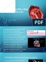 Синоатриальная блокада
