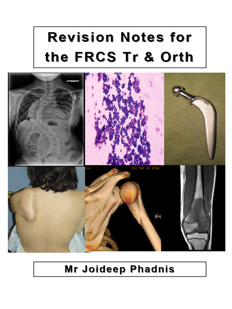 AAA Revision Notes For The FRCS TR Ortho Joideep Phadnis