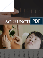 Acupuncture