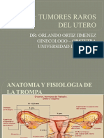 Tema 15 Tumores Raros Del Utero