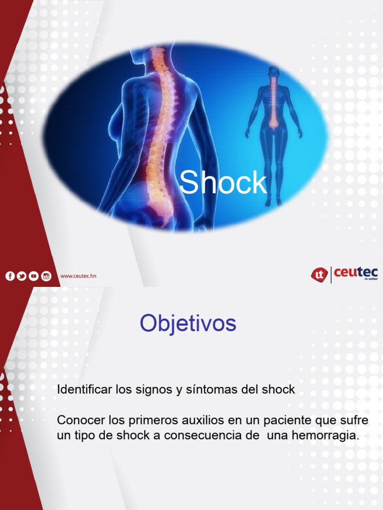 Primeros Auxilios en Shock Hemorrágico | PDF | Choque (circulatorio ...
