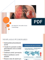 Neoplasias Pulmonares