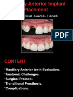 Maxillary Anterior Implant Placement