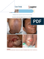 Multiple Skin Lesions in An HIV