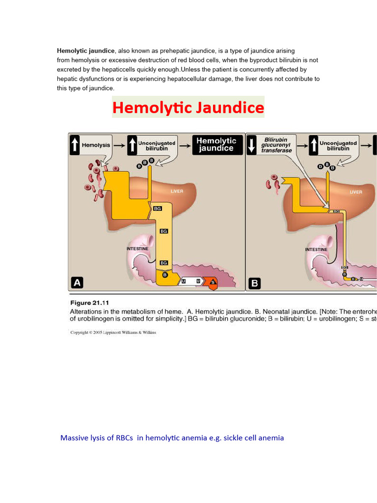 Hemolytic Jaundice PDF Tissue (Biology) Body Fluids