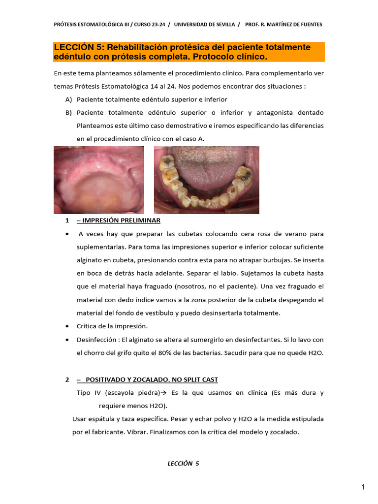 Rehabilitación de Pacientes Edéntulos | PDF | Dentadura postiza | Boca