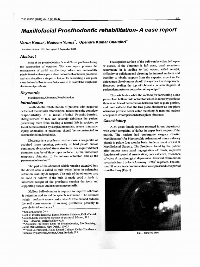 Maxillofacial Prosthodontic Rehabilitation - A Case Report | PDF