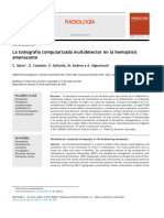 La Tomografía Computarizada Multidetector en La Hemoptisis Amenazante