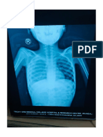 Pediatrics Xray