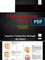 Ecg 2