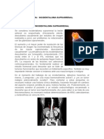 Incidentaloma Suprarrenal