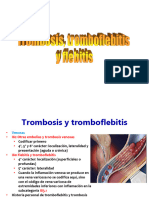 Flebitis, Aneurismas, Arteriosclerosis