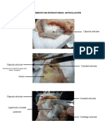 3 Reconocimiento de Estructuras Articulaciones