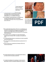 Inmunolofia y Fisiopatologia de La Lesion Neural .