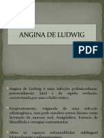 Angina de Ludwig