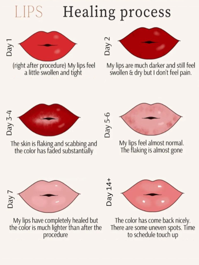 Lips Aftercare Instructions | PDF