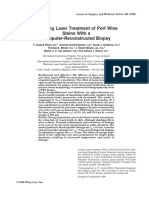 Modeling Laser Treatment of Port Wine Stains With A Computer-Reconstructed Biopsy