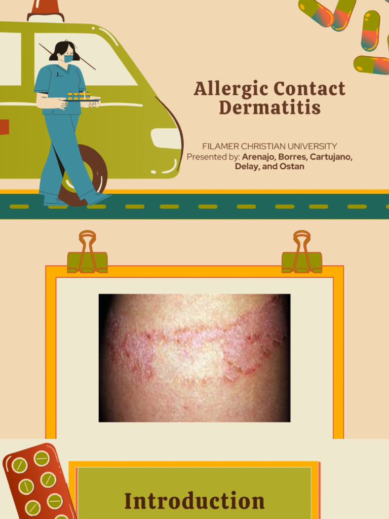 Allergic Contact Dermatitis Case Report PDF