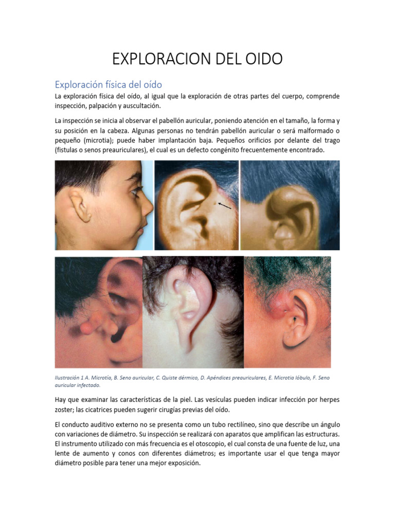 Exploracion Del Oido | PDF | Neurología | Medicina CLINICA