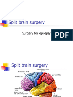 Split Brain Surgery