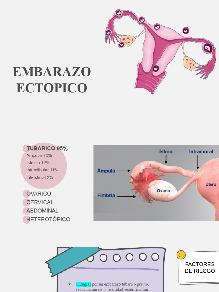 Embarazo Ectopico No Videos | Descargar gratis PDF | El embarazo ...