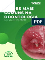 Lesões Mais Comuns Na Odontologia