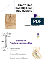 Fracturas Extremo Distal Humero