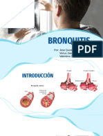 Bronquitis 
